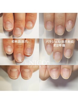 ニコプラス(NICO+)/自爪育成中