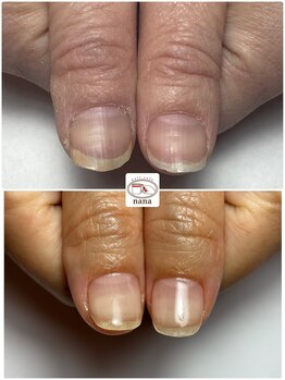 ネイルカフェ ナナ(nailcafe'nana)/自爪育成