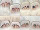 ヴィーナスネイル(Venus Nail)の写真