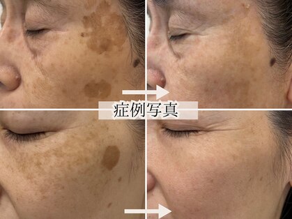 ハウオリ(HAUOLI)の写真