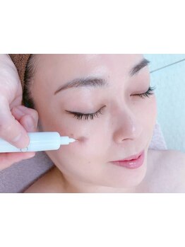 シミしわ改善！予防ケア