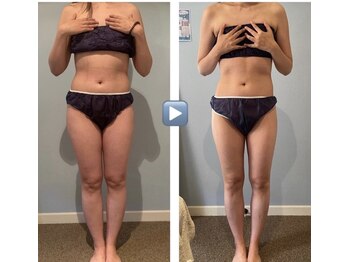 グレースフル 天文館店/短期集中痩せるならグレースフル