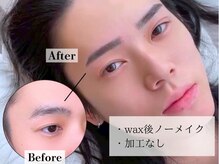 アンバーレス(AmberRes)