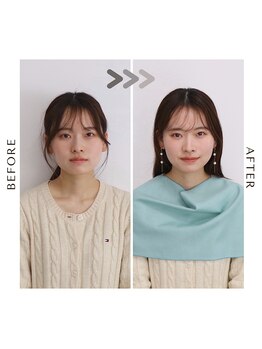 シュアリー(Surely)/トータルコースお客様事例