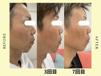 フラワー(FLOWER)の写真/メンズフェイシャルで第一印象UP！シワ・シミ・たるみケアで清潔感と若々しさを！