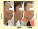 フラワー(FLOWER)の写真/メンズフェイシャルで第一印象UP！シワ・シミ・たるみケアで清潔感と若々しさを！