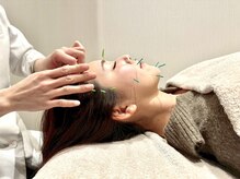 いちまる鍼灸院の雰囲気（美容鍼施術で肌質改善）