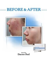 ドルチェビューティーサロン 戸塚安行店(Dolce Beauty Salon)/ダクトピール