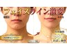 【肩こり＆小顔＆疲れスッキリ】体スッキリお顔ホッソリ（お試し￥１９８０）