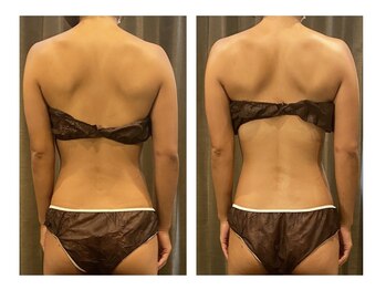 アールプラス(R+)/肩甲骨を美しく