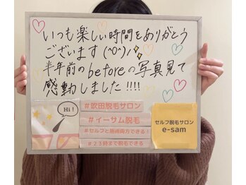 イーサム(e-sam)/☆顔脱毛☆