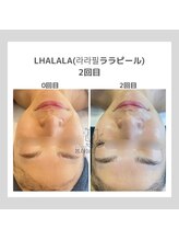 ポムハヌル(pom.haneul)/韓国肌管理室