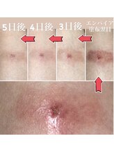 プレシャスサロン(precious salon)/エンパイア～ホームケア～