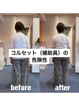 カワル整体 上通り院/【膝痛と腰痛のお客様】