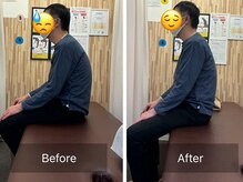 ナオル整体 札幌院(NAORU整体)/円山公園/西２８丁目/猫背矯正