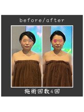 サロン ド ハーモニー美/コルギ♪小顔・お顔の幅を小さく