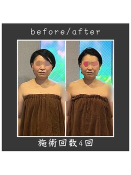 サロン ド ハーモニー美/コルギ♪小顔・お顔の幅を小さく