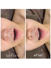 サロンシファ(salon sifa)/術後ケア