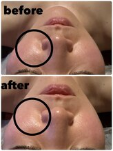 サロンドリマ(Salon de Lima)/小顔・リフトアップ！！