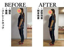 レストアハウス(RESTORE HOUSE)/姿勢改善はお悩み解決に超重要