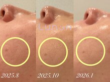 ルノン(Lunon)/ララピール