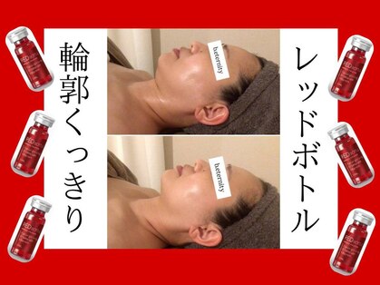 ビエタニティ(b.eternity)の写真