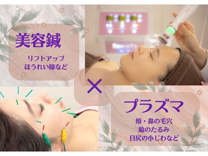 サーズ(SA’S)の写真