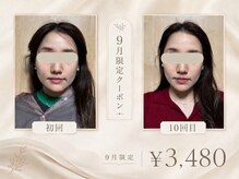asmot鍼灸 整体院 代々木上原(asmot鍼灸 整体院)