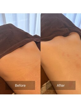 天使の艶肌 武蔵小杉店/意外と見られているその背中!