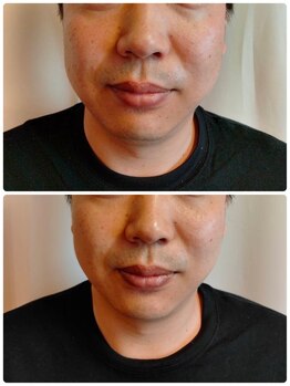 イズム(ism)/☆リフトアップフェイシャル☆