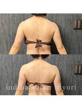 ヒヨリ(hiyori)/《before/after》肩こり改善