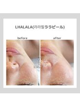 ポムハヌル 大阪梅田中崎町(pom.haneul)/韓国肌管理室