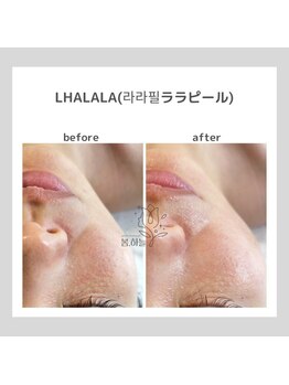 ポムハヌル 大阪梅田中崎町(pom.haneul)/韓国肌管理室