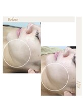 アイ アンド ネイル(Eye＆Nail Day)/クリスティーナイラストリアス