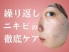 【繰り返しニキビの徹底ケア！】全顔ハーブピーリング+プラズマ（剥離なし）