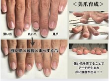 クウ(KUU)/結婚式に向けて！美爪育成