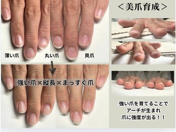 クウ(KUU)/結婚式に向けて!美爪育成