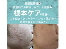 ラ ミュエル(La miel)