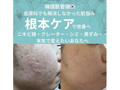 ラ ミュエル(La miel)の写真