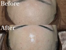 ディアーム 光明池店(Diarm)/陶肌ピール