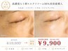 人気No1【迷ったらこれ】最強エイジングケア ヒト幹96%美容液導入/AI肌測定付