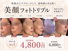 トレース