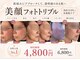 トレースの写真