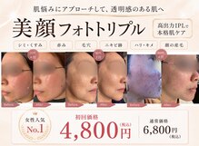 トレース