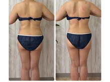 大人女性の痩身専門サロン AVENIR【アヴニール】の雰囲気（脂肪にしっかりアプローチして、強く押し流すことで燃焼♪）