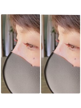 エマ 桃山台(emma)/snap