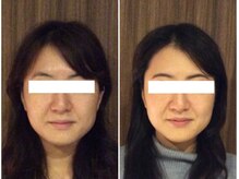 美容整体ウェリナ あま甚目寺院/小顔矯正/骨盤矯正/美脚サロン