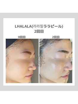 ポムハヌル(pom.haneul)/韓国肌管理室