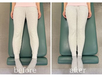 カイロラインメディカル整体 平塚院(Chiro Line)/産後骨盤矯正×腰痛/BeforeAfter