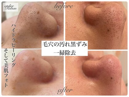 アトリエリュバン 梅田店(atelier Ruban)の写真